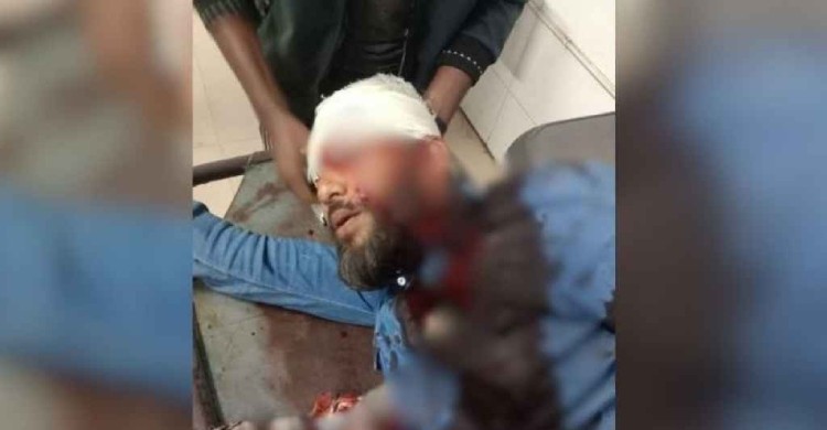 এবার এনসিপি নেতাকে প্রকাশ্যে গুলি