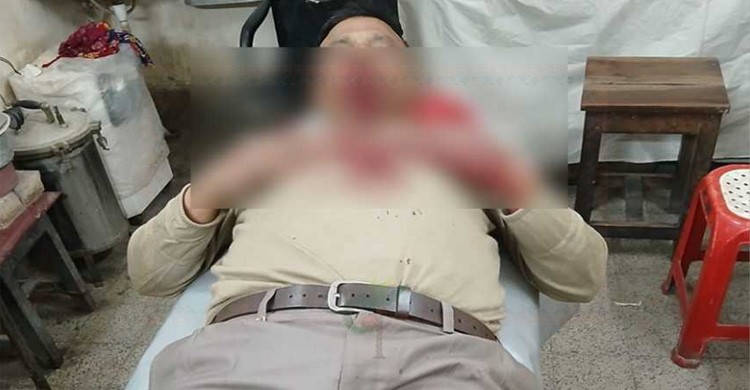 বিয়ের দাওয়াত না দেয়ায় সাবেক সেনাসদস্যকে কুপিয়ে জখম