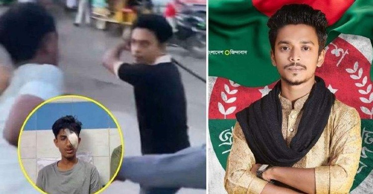 আলিফের চোখ হারানোর ঘটনায় ফেসবুকে সমালোচনার ঝড়, প্রশংসাও পাচ্ছেন অভিযুক্ত ছাত্রদল নেতা!